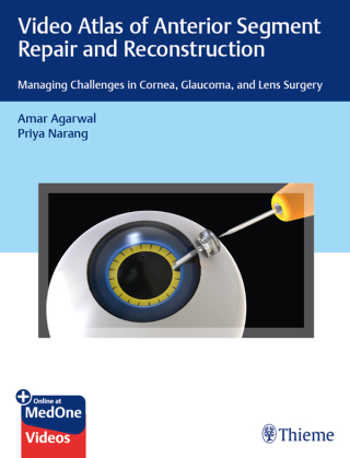 表紙画像: Video Atlas of Anterior Segment Repair and Reconstruction 1st edition 9781684200979