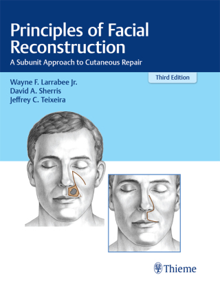 Cover image: Principles of Facial Reconstruction 3rd edition 9781684201068