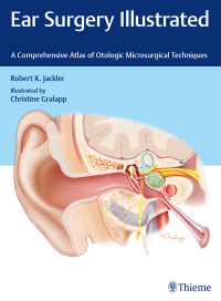 Imagen de portada: Ear Surgery Illustrated 1st edition 9781684201105