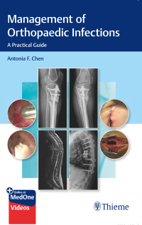 Cover image: Management of Orthopaedic Infections 1st edition 9781684201334