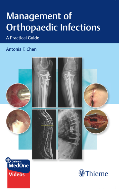 Management of Orthopaedic Infections: A Practical Guide, 1st Edition - FULL INSTANT DOWNLOAD | PDF DOCX EPUB