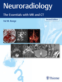 Cover image: Neuroradiology 2nd edition 9781684201532