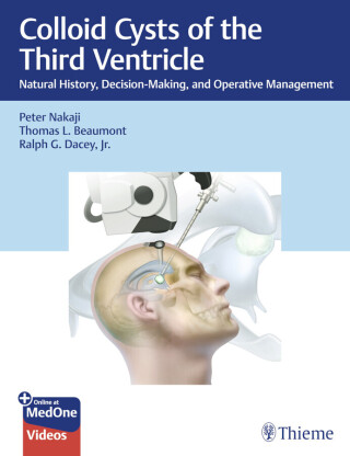 Cover image: Colloid Cysts of the Third Ventricle 1st edition 9781684201563