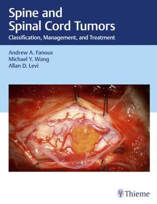 Cover image: Spine and Spinal Cord Tumors 1st edition 9781684201631