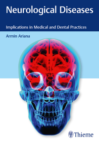 表紙画像: Neurological Diseases 1st edition 9781684202249