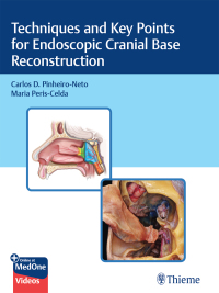 Cover image: Techniques and Key Points for Endoscopic Cranial Base Reconstruction 1st edition 9781684202324