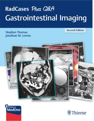 Cover image: RadCases Plus Q&A Gastrointestinal Imaging 2nd edition 9781626238688