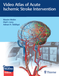 Cover image: Video Atlas of Acute Ischemic Stroke Intervention 1st edition 9781684202492