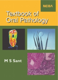 Omslagafbeelding: Textbook of Oral Pathology 9781642873733