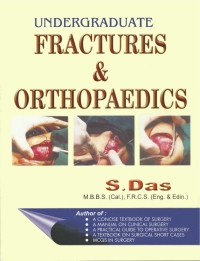 Imagen de portada: Undergraduate Fractures & Orthopaedics 9781642874693