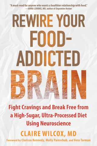 Cover image: Rewire Your Food-Addicted Brain 9781648484681