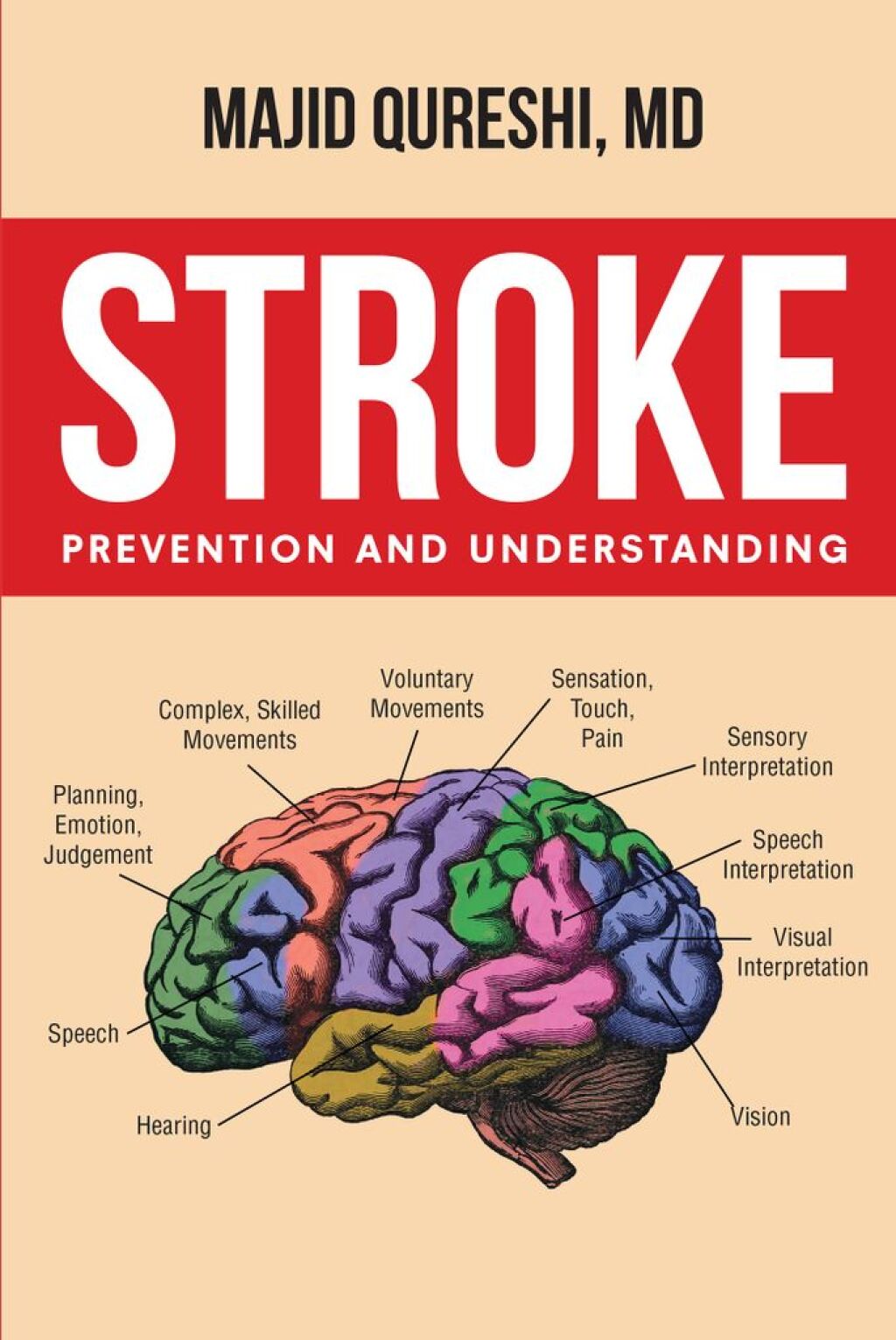 Stroke (eBook)