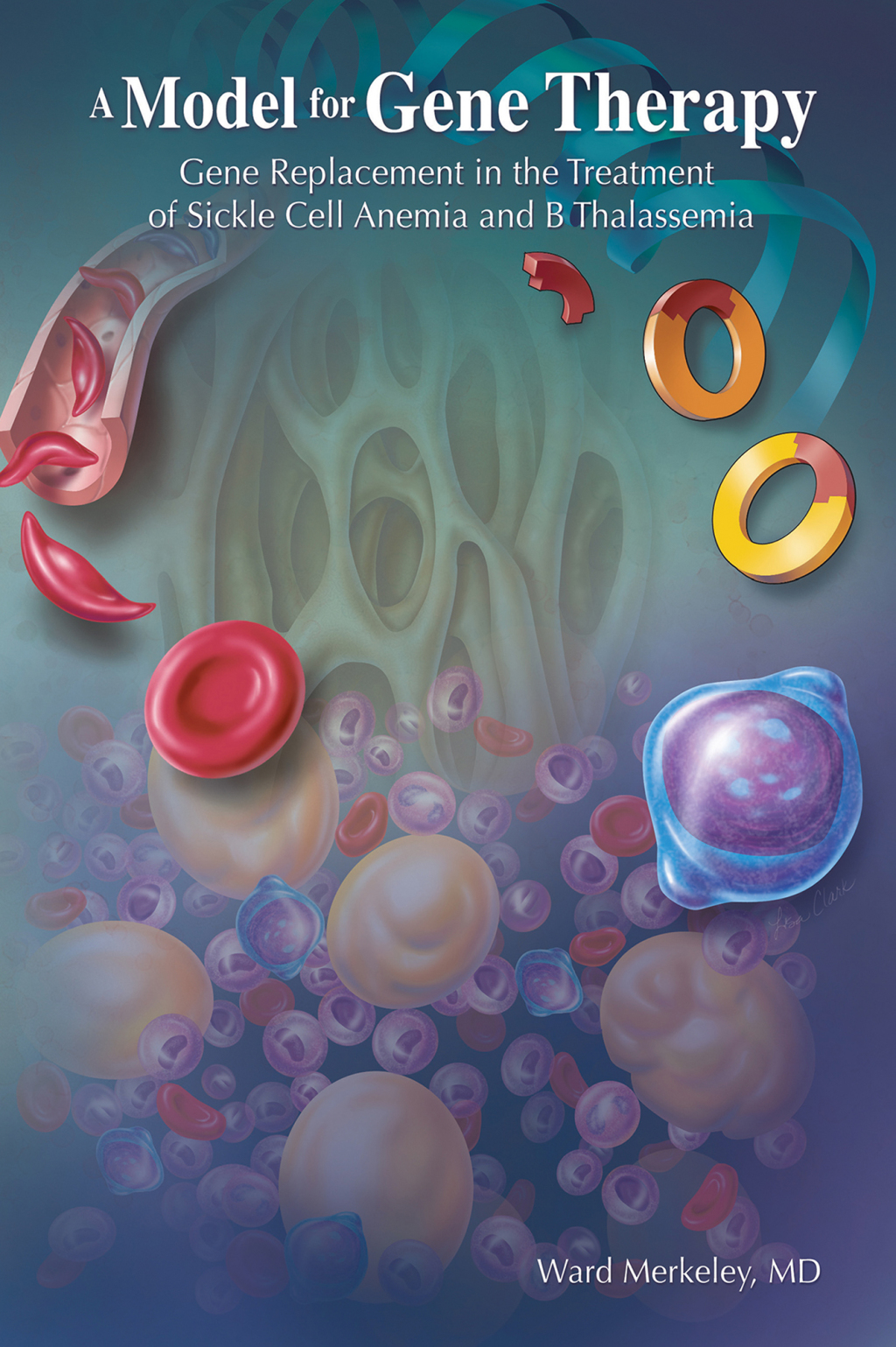 A Model for Gene Therapy Gene Replacement in the Treatment of Sickle Cell Anemia and  Thalassemia