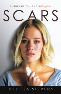 Cover image: Scars 9781664242043