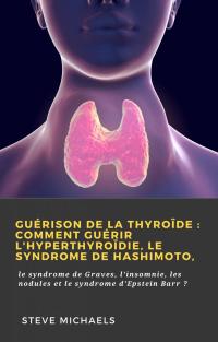 صورة الغلاف: Guérison de la thyroïde : Comment guérir l'hyperthyroïdie, le syndrome de Hashimoto, 9781667405049
