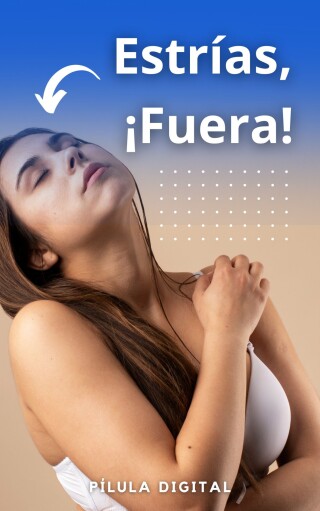 Cover image: Estrías, ¡Fuera! 9781667477190