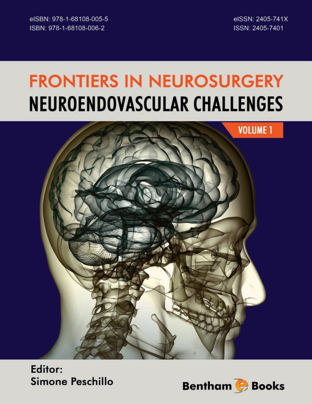 Frontiers in Neurosurgery Volume 1: NeuroEndovascular Challenges 1st Edition