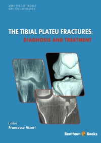 Cover image: The Tibial Plateau Fractures: Diagnosis and Treatment 1st edition 9781681082424