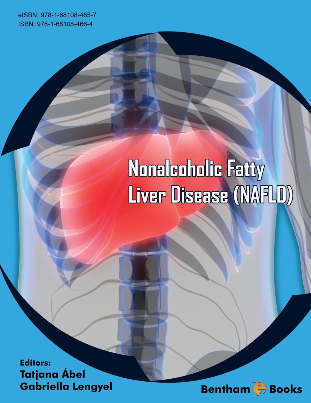 Nonalcoholic Fatty Liver Disease (NAFLD) 1st Edition