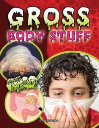 Imagen de portada: Gross Body Stuff 9781681918686