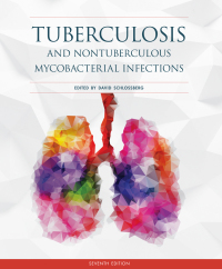 صورة الغلاف: Tuberculosis and Nontuberculous Mycobacterial Infections 7th edition 9781555819859
