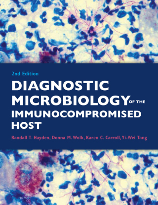 表紙画像: Diagnostic Microbiology of the Immunocompromised Host 2nd edition 9781555819033