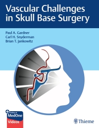 Cover image: Vascular Challenges in Skull Base Surgery 1st edition 9781684200689