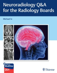 صورة الغلاف: Neuroradiology Q&A for the Radiology Boards 1st edition 9781684205592