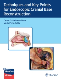 Cover image: Techniques and Key Points for Endoscopic Cranial Base Reconstruction 1st edition 9781684202324