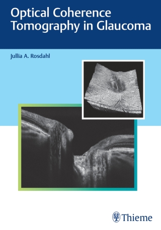 Cover image: Optical Coherence Tomography in Glaucoma 1st edition 9781684202478