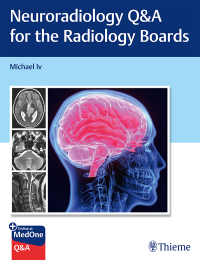 Immagine di copertina: Neuroradiology Q&A for the Radiology Boards 1st edition 9781684205592