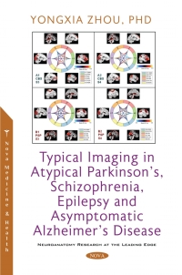 Cover image: Typical Imaging in Atypical Parkinson's, Schizophrenia, Epilepsy and Asymptomatic Alzheimer's Disease 9781536199390