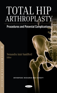 Omslagafbeelding: Total Hip Arthroplasty: Procedures and Potential Complications 9781685071462