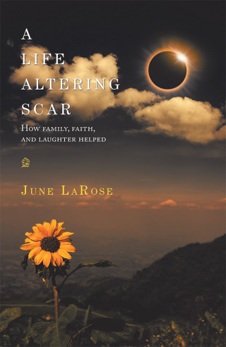 Cover image: A Life Altering Scar 9781728348742