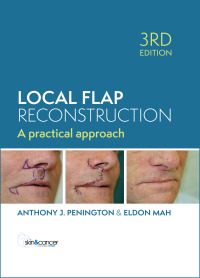 Cover image: Local Flap Reconstruction 3rd edition 9781743768303