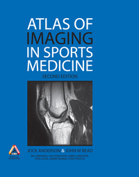 Imagen de portada: EBOOK Atlas of Imaging in Sports Medicine 2nd edition 9780074715840