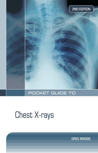 Cover image: Pocket Guide to Chest X-Rays 2nd edition 9780070138773