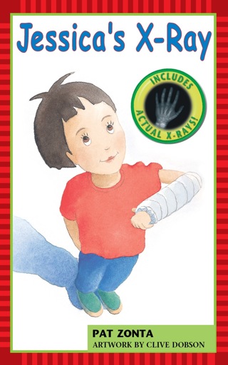 Cover image: Jessica's X-Ray 9781552975770