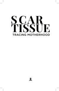 表紙画像: Scar Tissue 9781773901367