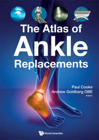 Cover image: The Atlas of Ankle Replacements 1st edition 9781786346230