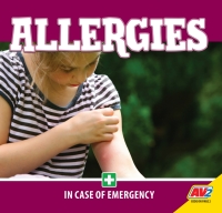 Cover image: Allergies 1st edition 9781791126568