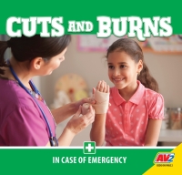 Cover image: Cuts and Burns 1st edition 9781791126643