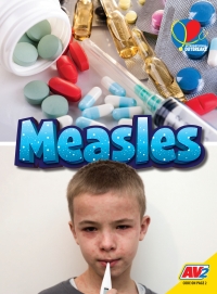 Imagen de portada: Measles 1st edition 9781791132262