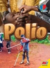 Imagen de portada: Polio 1st edition 9781791132385