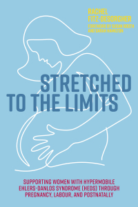 Cover image: Stretched to the Limits 9781839972492
