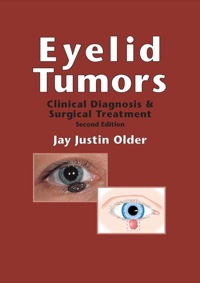Imagen de portada: Eyelid Tumors 2nd edition 9781840760293
