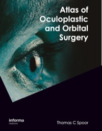Cover image: Atlas of Oculoplastic and Orbital Surgery 1st edition 9781841845869