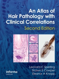 表紙画像: An Atlas of Hair Pathology with Clinical Correlations 2nd edition 9781841847337