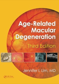 Imagen de portada: Age-Related Macular Degeneration, Third Edition 3rd edition 9781841849492