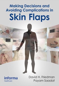 Titelbild: Making Decisions and Avoiding Complications in Skin Flaps 1st edition 9781841849850